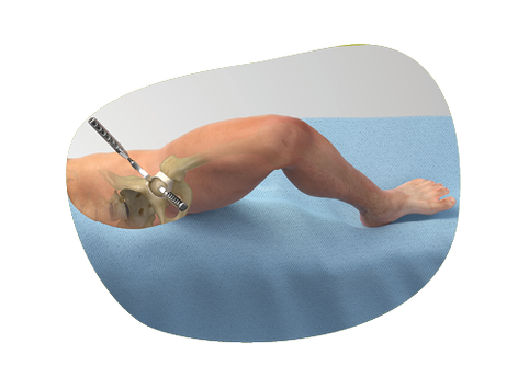 Approach flexibility